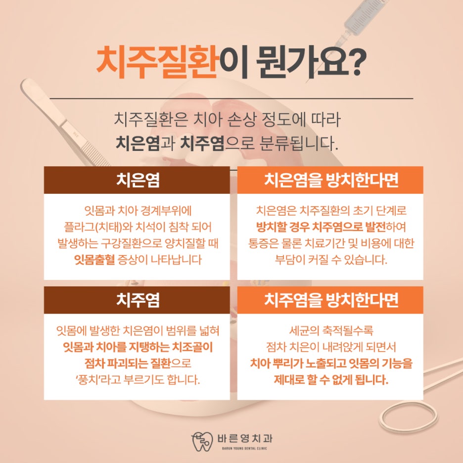 약수치과 잇몸 부었을 때 치주질환 의심해봐야 사진 4