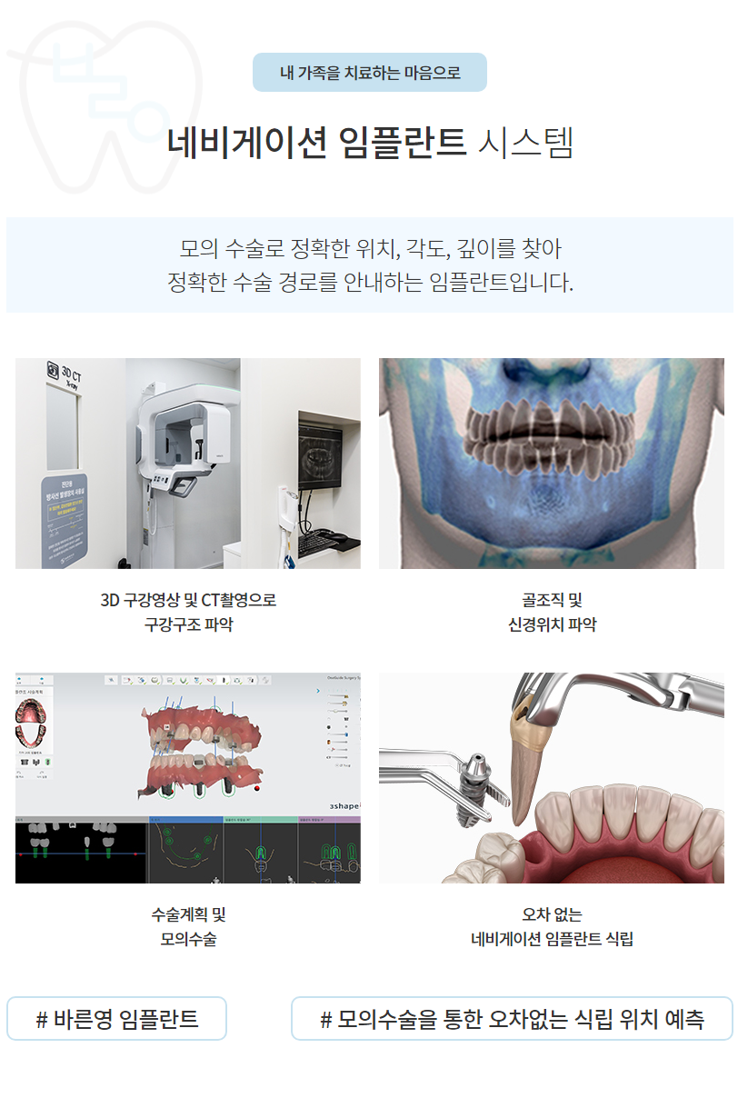 신당역치과 잃어버린 치아 네비게이션 임플란트로 되찾으세요 사진 6