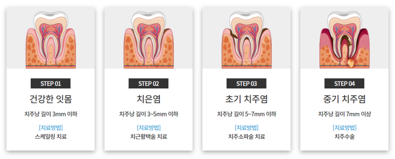 약수역치과, 양치할 때 피 난다면 잇몸염증치료 필요해요 사진 10
