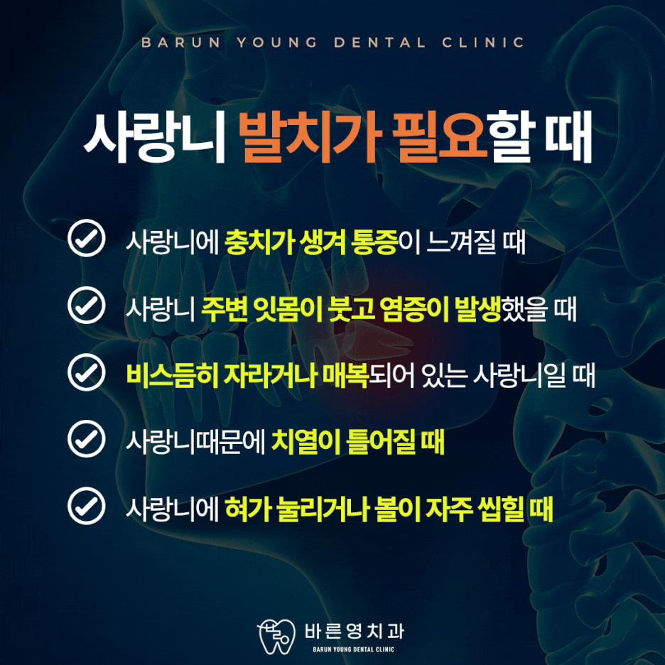 신당동치과, 사랑니발치가 꼭 필요한 순간들