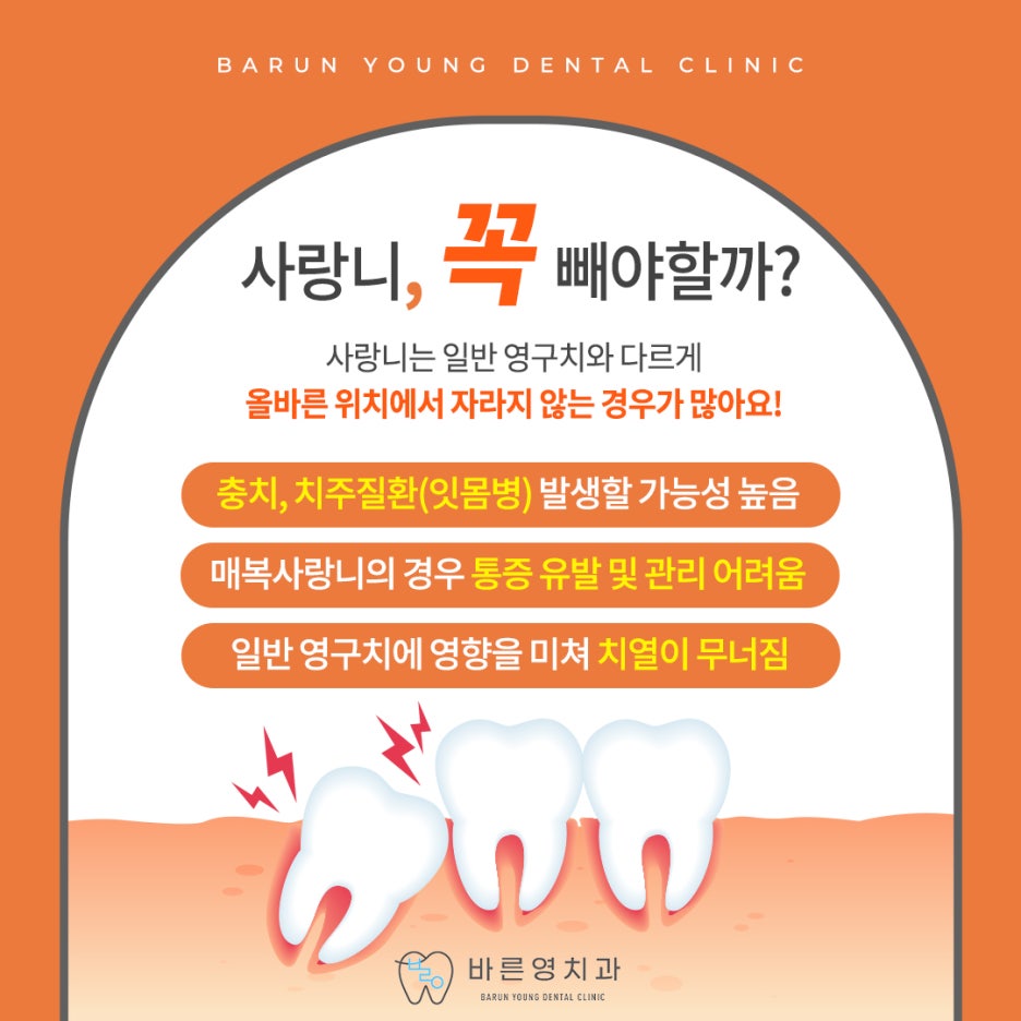 신당동치과, 사랑니발치가 꼭 필요한 순간들 사진 5