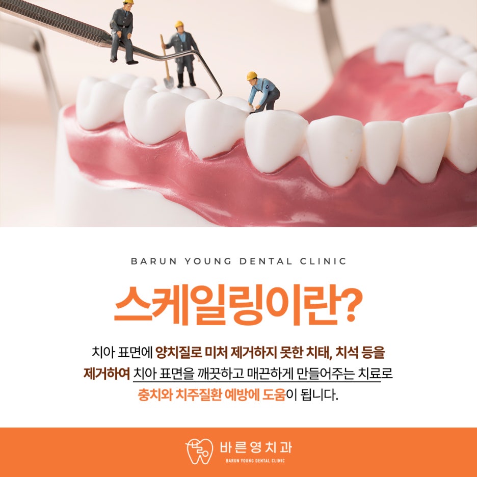 Dasan-dong Dental Clinic, Jika Gusi Berdarah dan Bau Mulut Parah, Mungkin Penyakit Periodontal 사진 6