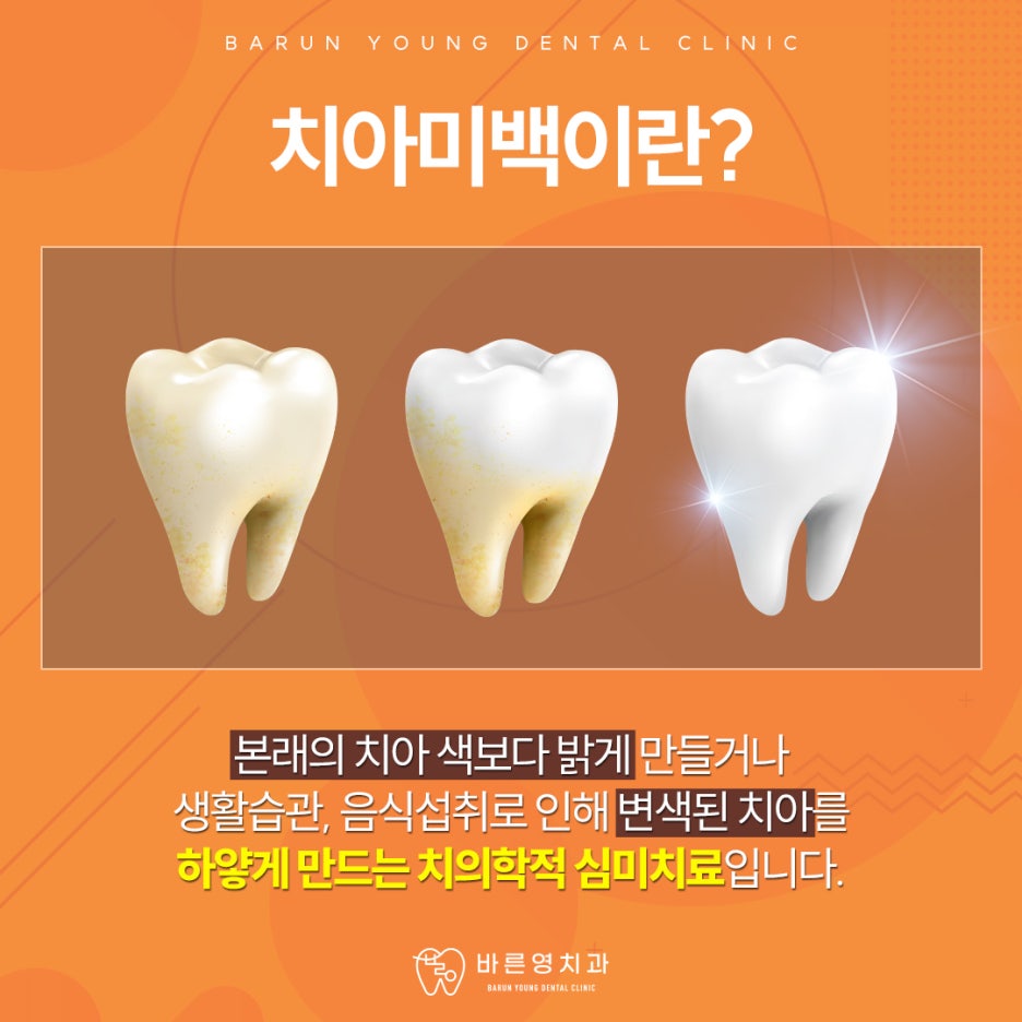 옥수역치과, 당당하게 웃게 해주는 치아미백 치료 원한다면
