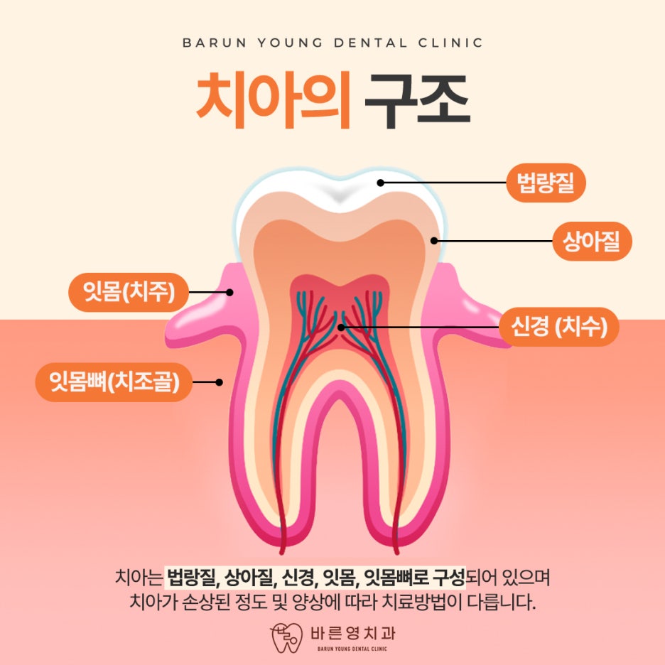 금호역 치과, 자연치아 살리는 마지막 단계 신경치료의 중요성