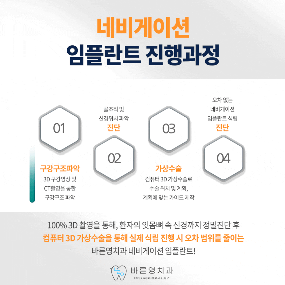 약수역치과, 만족도 높은 임플란트 치료 원한다면? 사진 14