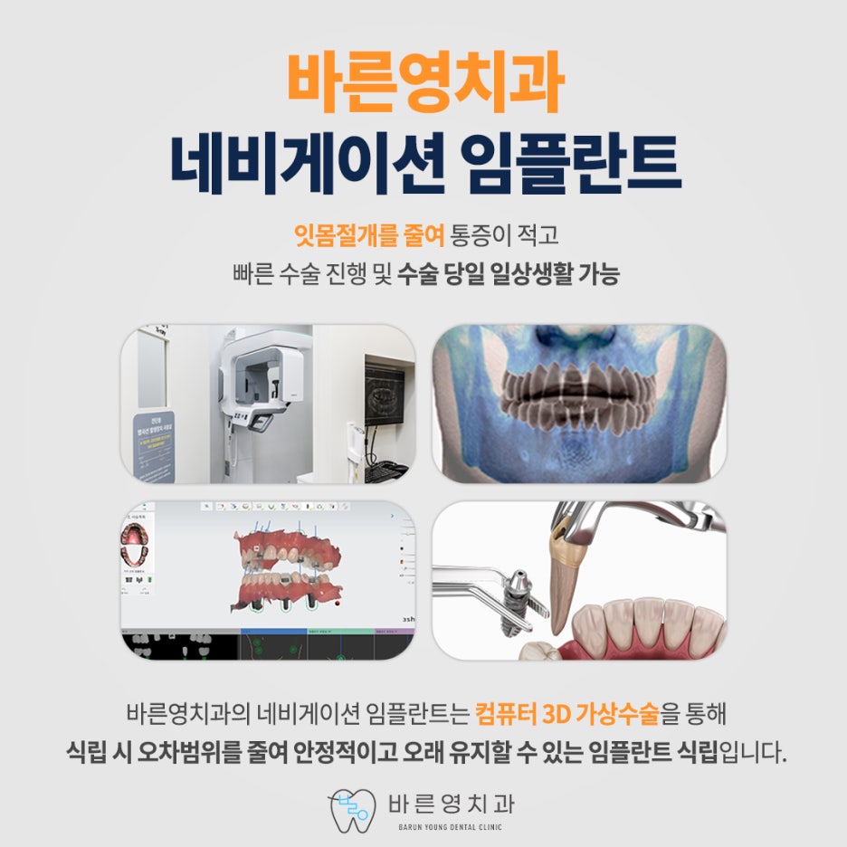 약수역치과, 만족도 높은 임플란트 치료 원한다면? 사진 13