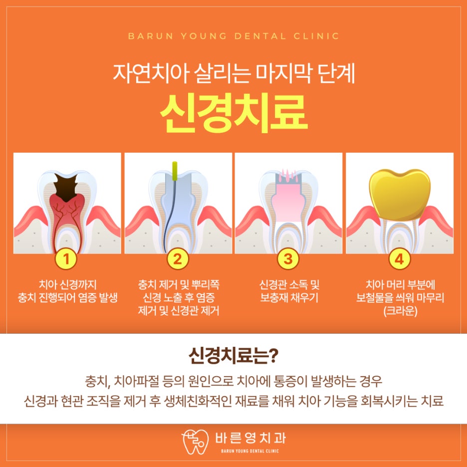 금호역치과, 통합치의학과 전문의가 1:1로 하는 충치신경치료 사진 8