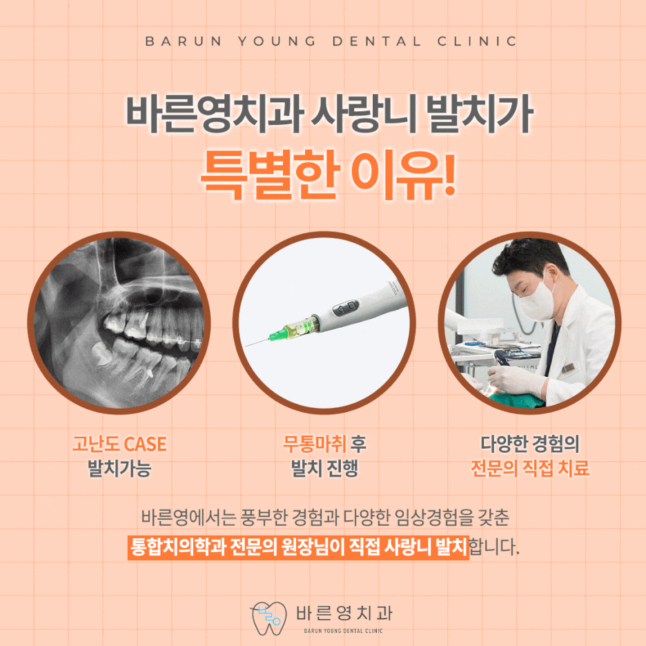 약수동치과, 사랑니 발치 고민하지 마세요. 사진 15