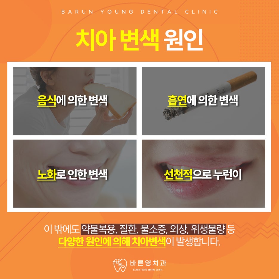 신당동치과, 치아미백 할 때 연령과 피부톤까지 고려해야