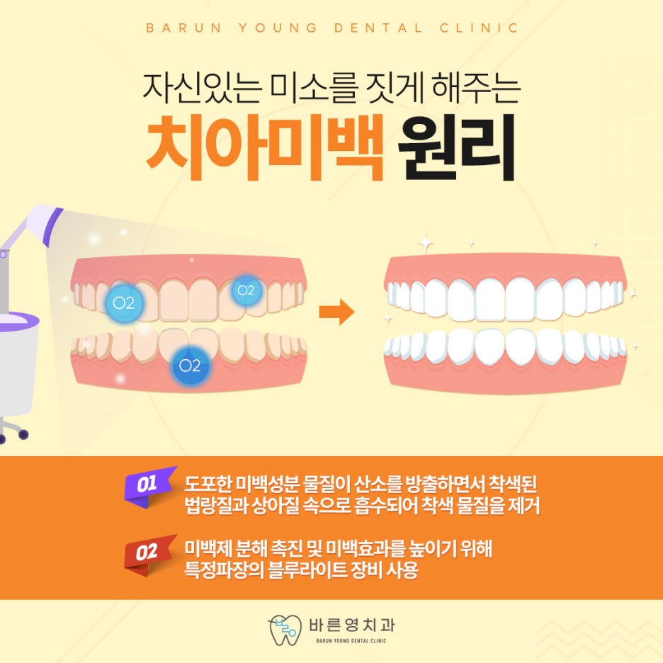 신당동치과, 치아미백 할 때 연령과 피부톤까지 고려해야 사진 6