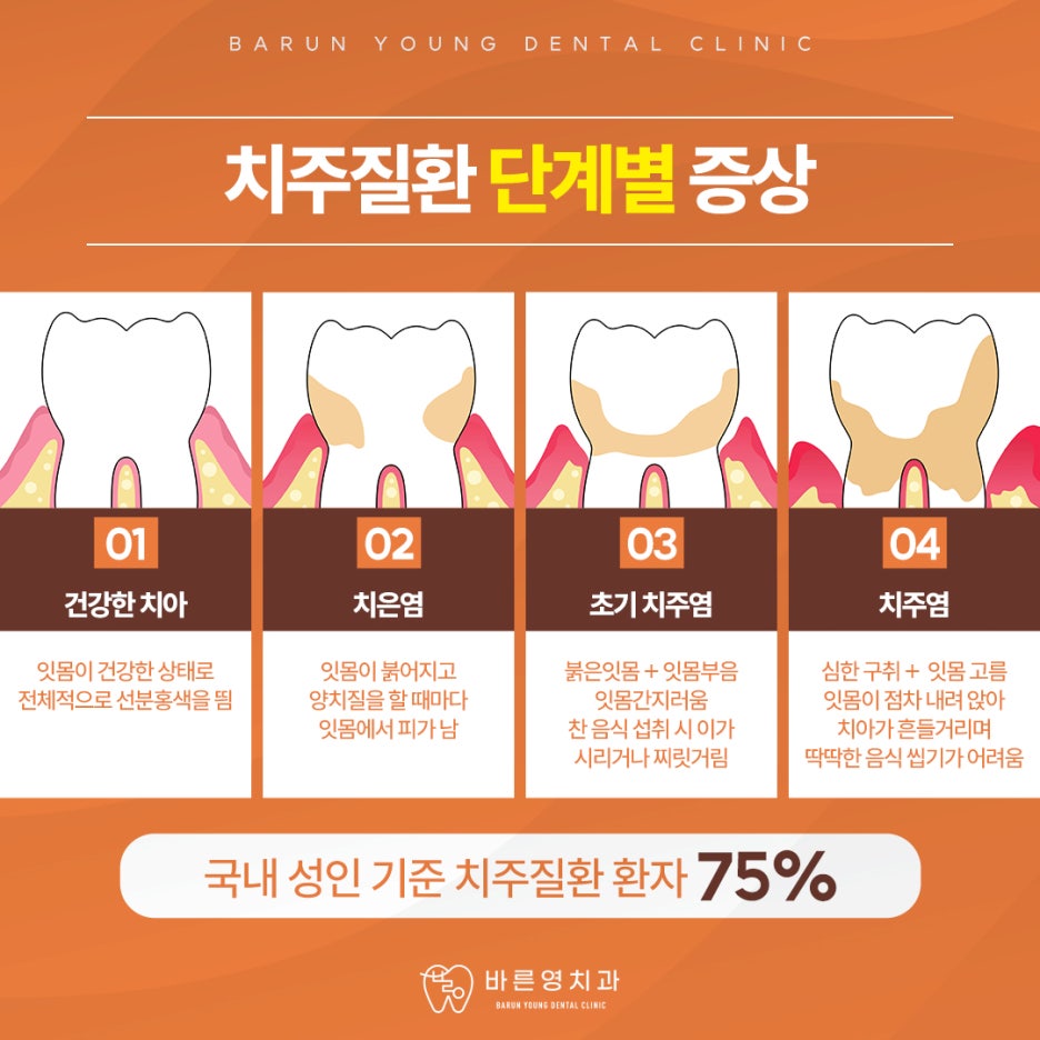 신당역치과 치은염 치주염 치아 잃기 전에 조기예방하려면 사진 9