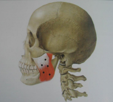 Yaksuyeok Dental Clinic, Temporomandibular Joint Disorders (Botox Treatment) 사진 4