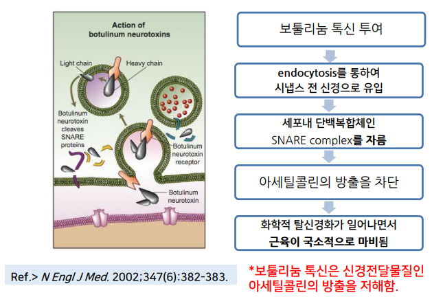 Yaksuyeok Dental Clinic, Temporomandibular Joint Disorders (Botox Treatment)