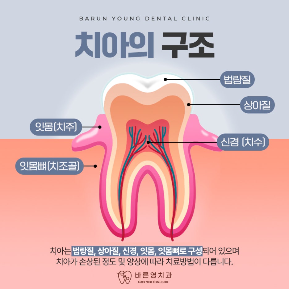 Cheonggudong Dental Clinic: Don't Miss the Timing for Cavity and Root Canal Treatment 사진 6
