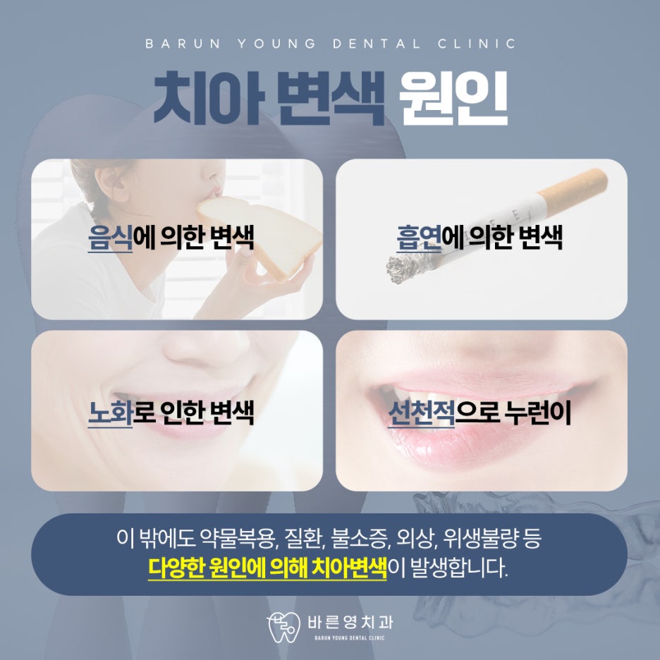 장충동치과 치아미백 빠른 효과 원한다면
