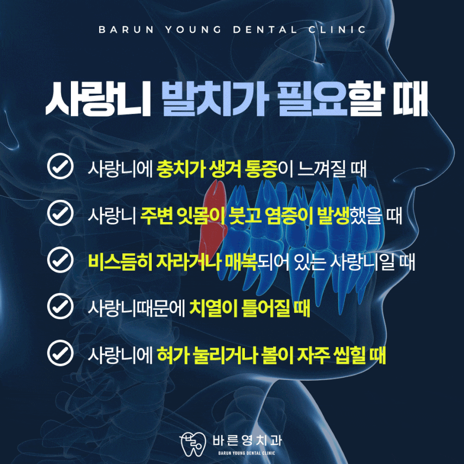 신당동치과 사랑니 발치가 필요한 순간은 사진 2