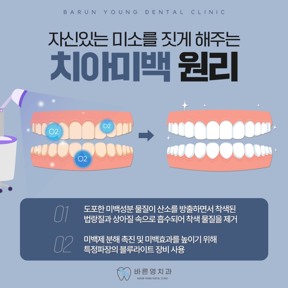 금호동치과 자연스러운 치아미백 치료를 돕는 바른영치과 사진 3