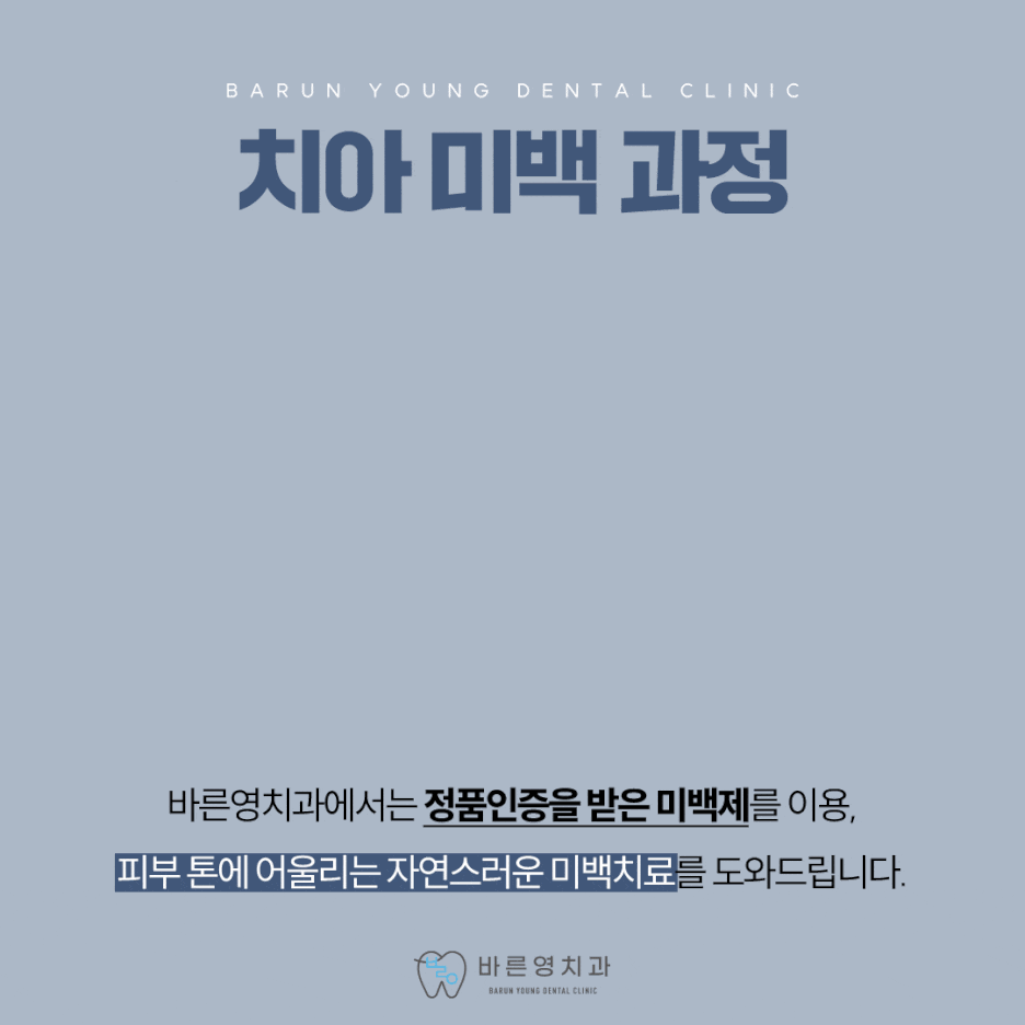 금호동치과 자연스러운 치아미백 치료를 돕는 바른영치과 사진 5