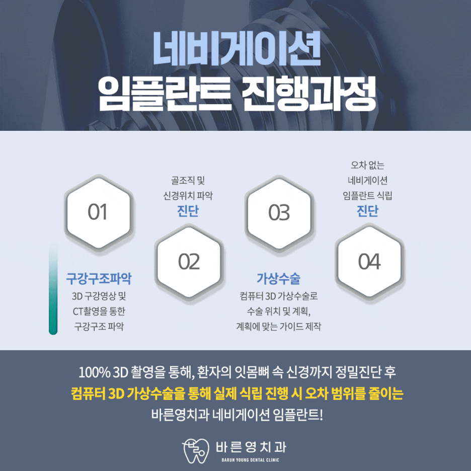 다산동치과, 안정적인 임플란트 치료 원한다면 네비게이션 임플란트로 사진 7