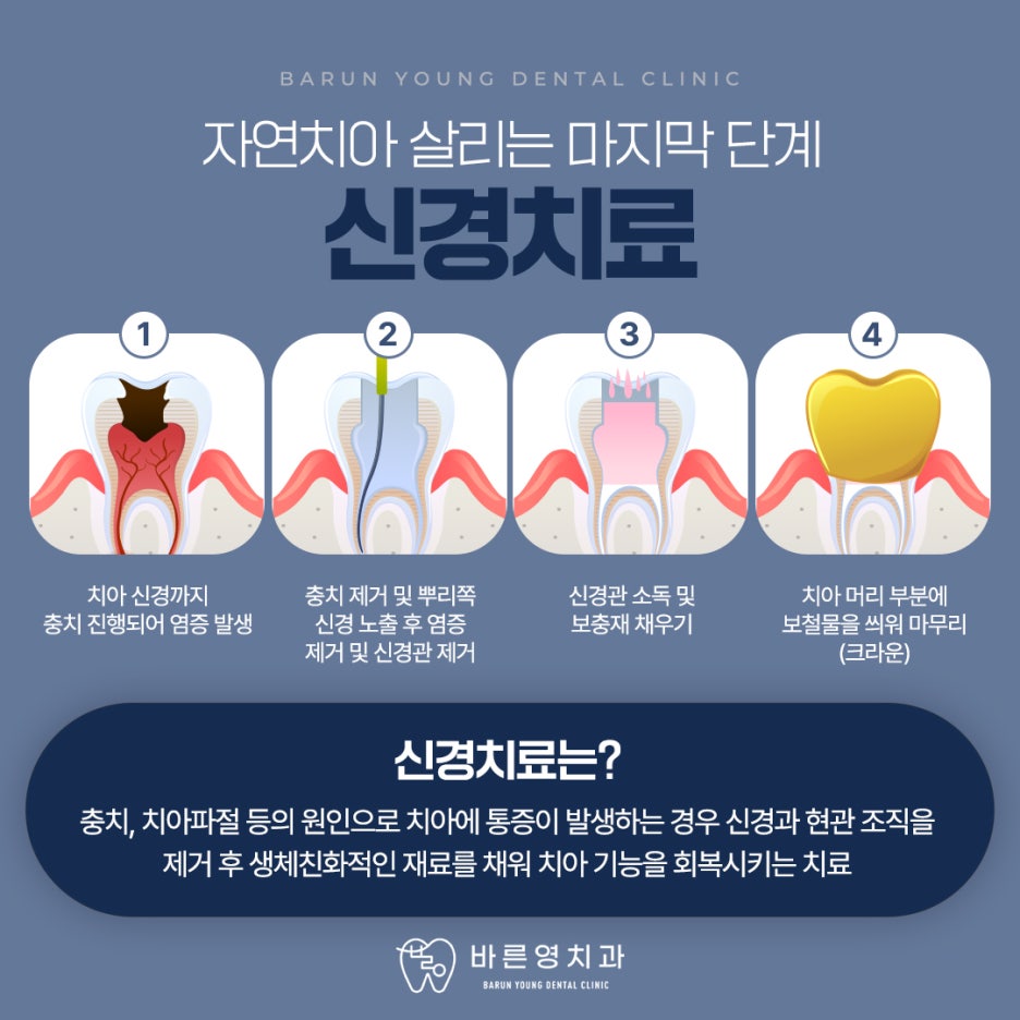 Yaksu Dental Clinic: Early Intervention for Cavity and Root Canal Treatment Leads to Better Prognosis 사진 7