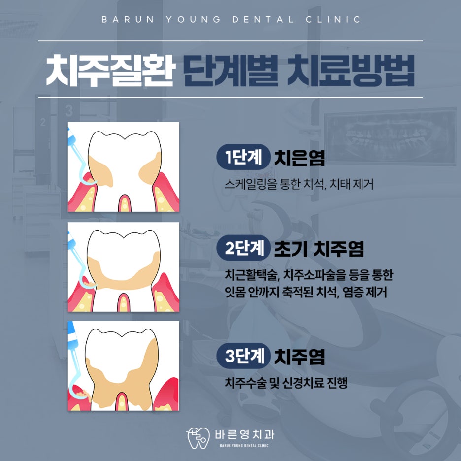 금호동치과 자주 나는 잇몸 피 치주질환 치료로 사진 10