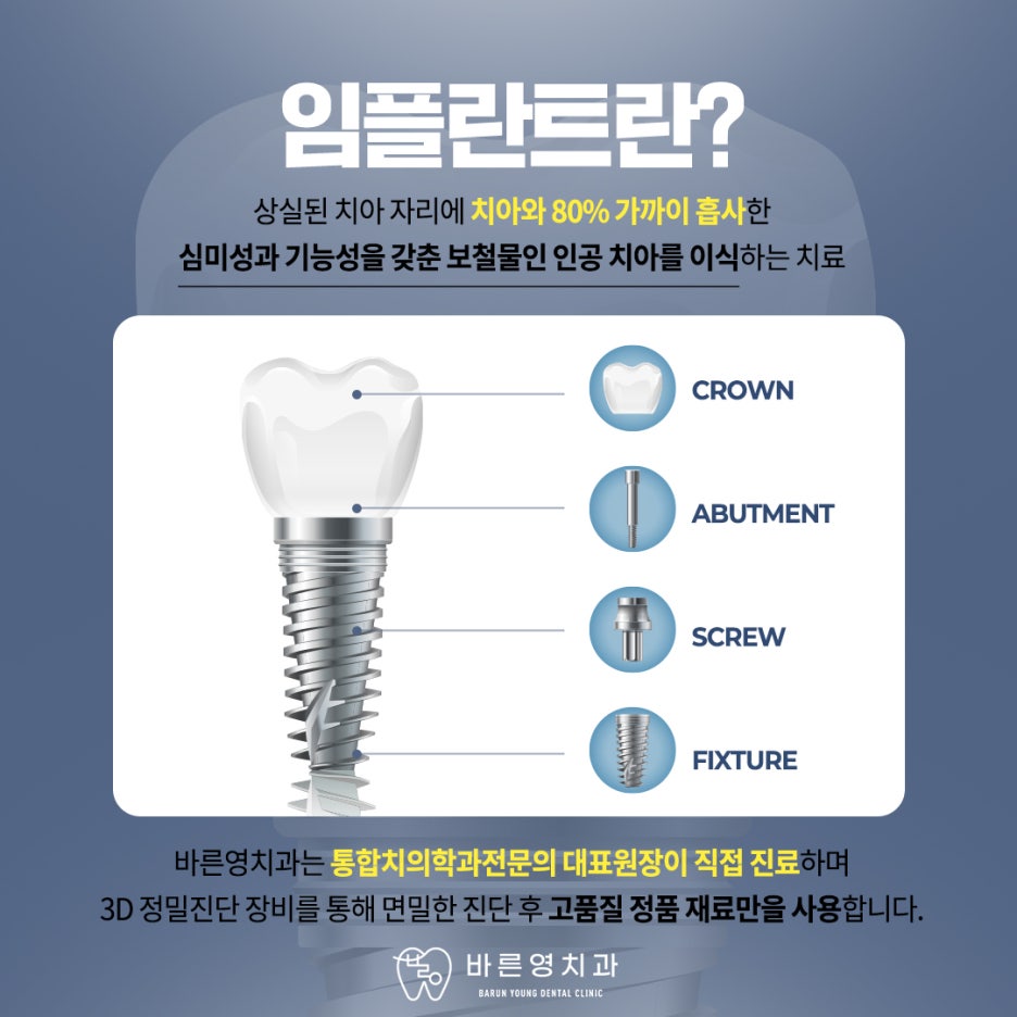 금남시장치과 미리 확인한 길 따라 진행해 안정적인 임플란트 사진 2