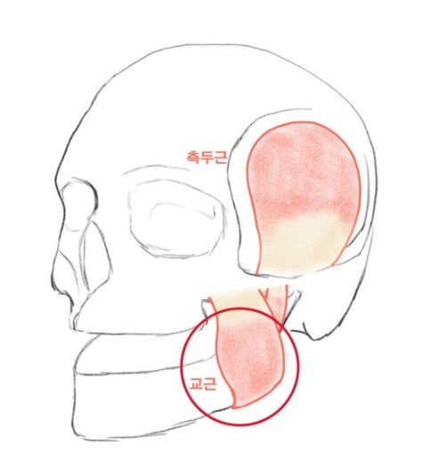 Klinik Gigi Sindang-dong, Gejala yang Dapat Muncul Setelah Suntikan Botox Rahang (Rahang Kotak, Otot Pengunyah, Fenomena