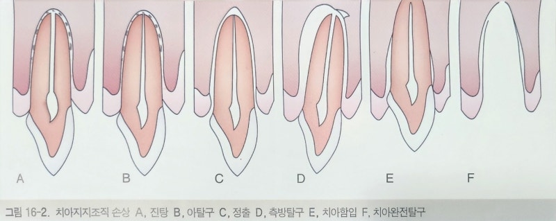 Yaksu Station Dental Clinic: Treating Loose Teeth After Falls or Trauma (Esthetic Prosthetics, Root Canal Treatment, Too