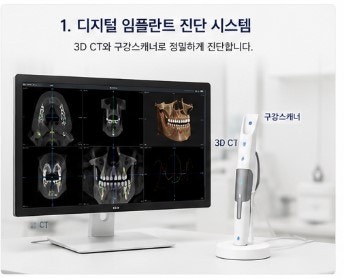 약수역치과 디지털 장비를 이용한 효율적인 임플란트 수술 및 장점
