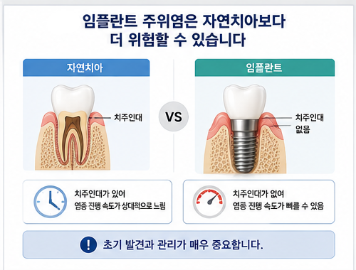 약수역 치과, 임플란트도 잇몸병이 생길 수 있을까요? 사진 3