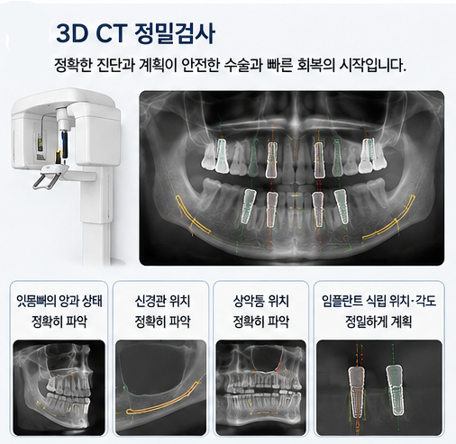 약수역 전체임플란트, 임플란트 수술은 얼마나 아플까요? 사진 4